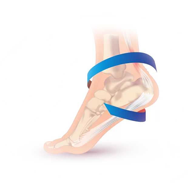 флекстра flextra